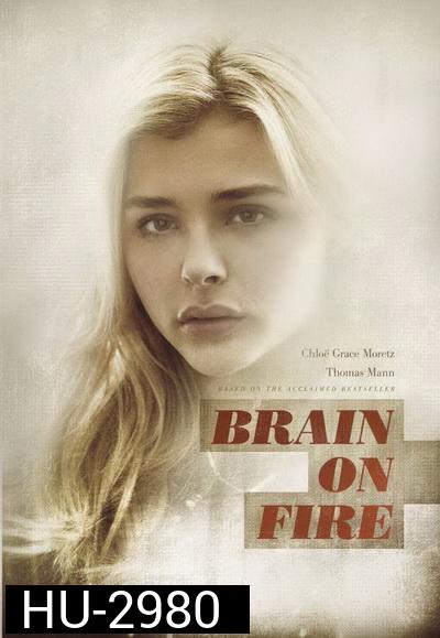 Brain on Fire เผชิญหน้า ท้าปาฏิหาริย์